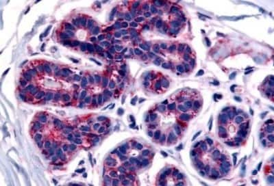 Immunohistochemistry-Paraffin: TRIB3 Antibody [NBP3-14504] - Immunohistochemistry of formalin-fixed, paraffin-embedded human breast after heat-induced antigen retrieval.